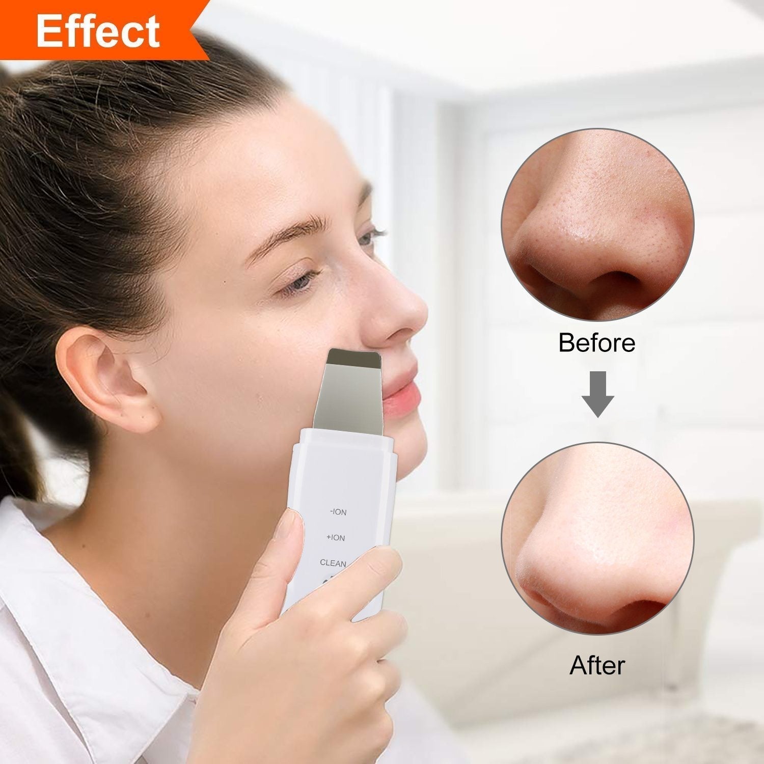 Anlan™-Ultrasonic Skin Scrubber